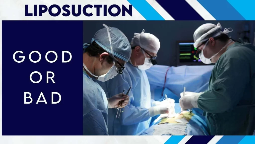Liposuction: Good or Bad