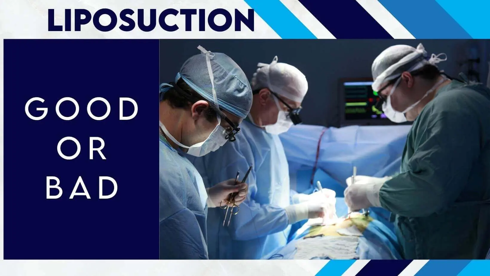 Liposuction: Good or Bad