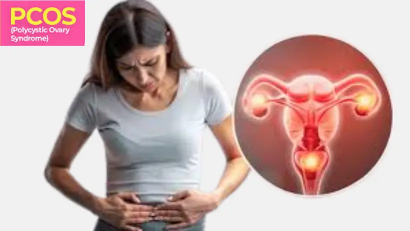 PCOS and Fitness: A Comprehensive Guide to Healthier Living